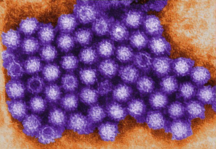 UGA to help guide development of norovirus vaccine